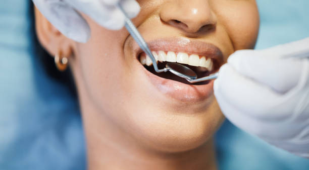 Best Emergency Root Canal Treatment in Dallas Center, IA