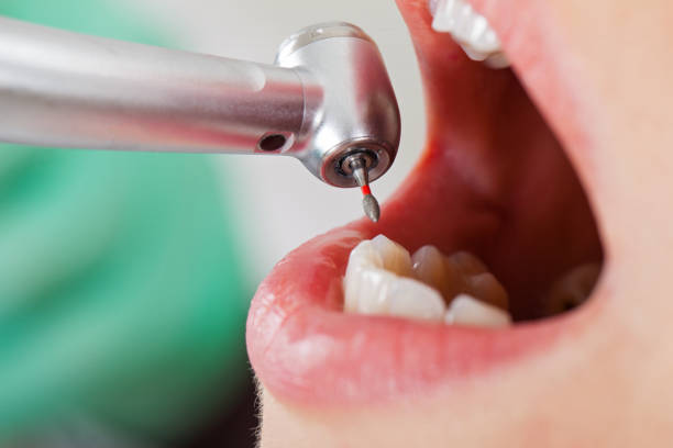 Best Emergency Dental Care for Abscessed Tooth in Dallas Center, IA